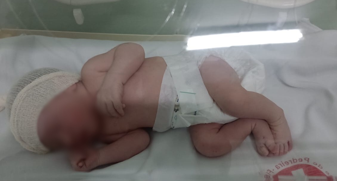 a foto mostra o bebê encontrado abandonado no hostpital, dentro de um berço recebendo cuidados