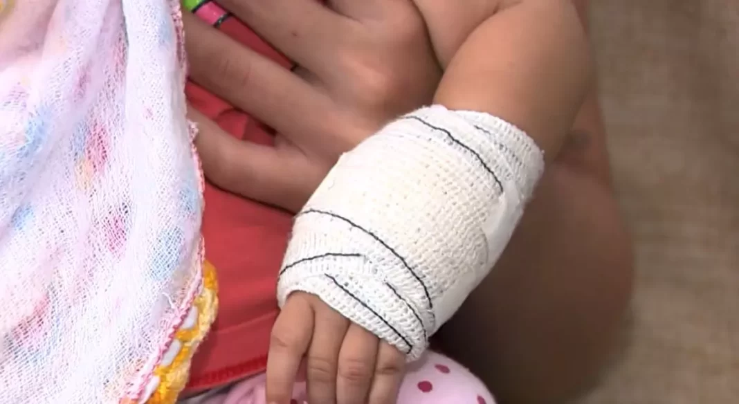 a foto mostra a mão da bebê que foi alvo de negligência
