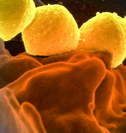 Japão enfrenta aumentos de casos graves de bactéria Streptococcus pyogenes